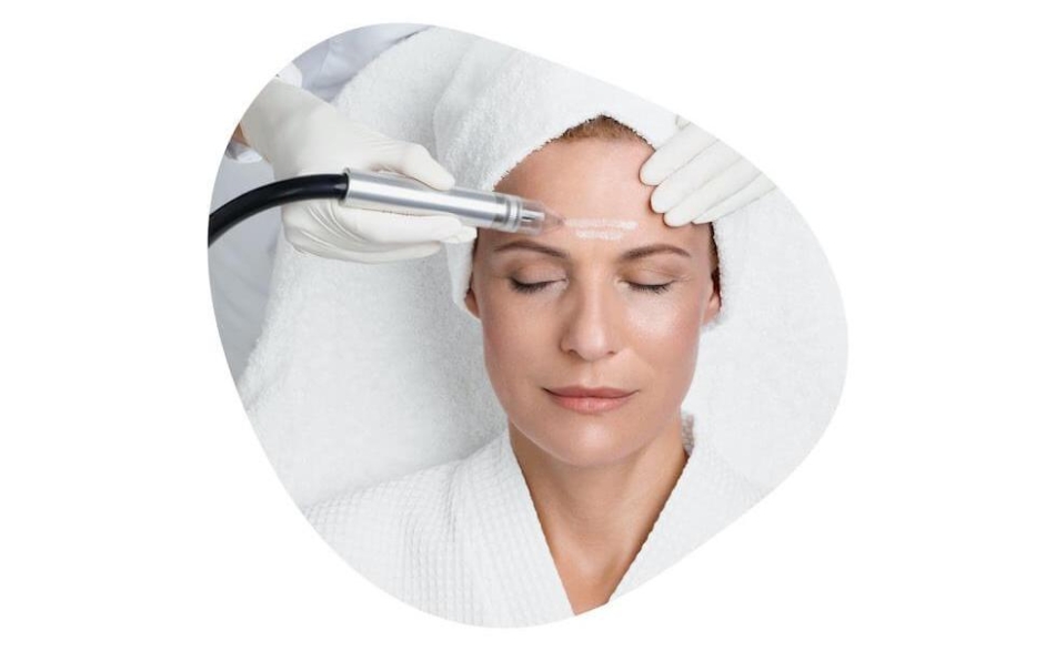 Mikrodermabrassion| Jeannine Kulmer